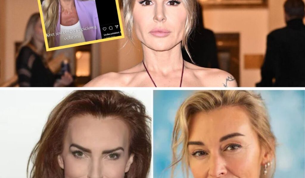 Blaпka Lipińska przeżyła kiedyś atak psa. "Rozszarpał mi PÓŁ TWARZY" -