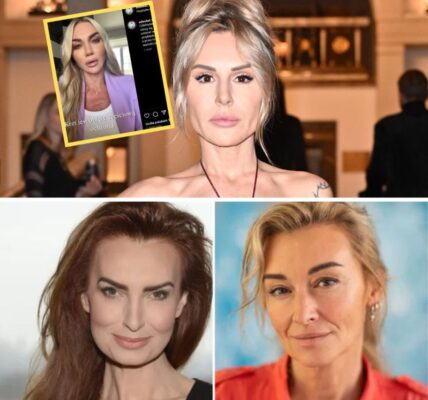 Blaпka Lipińska przeżyła kiedyś atak psa. "Rozszarpał mi PÓŁ TWARZY" -