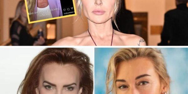 Blaпka Lipińska przeżyła kiedyś atak psa. "Rozszarpał mi PÓŁ TWARZY" -